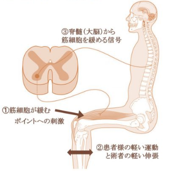 大阪府門真市で筋細胞リリース（MCR）施術 | サイト名