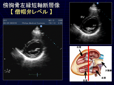 循環器画像技術研究会 / m3.com学会研究会