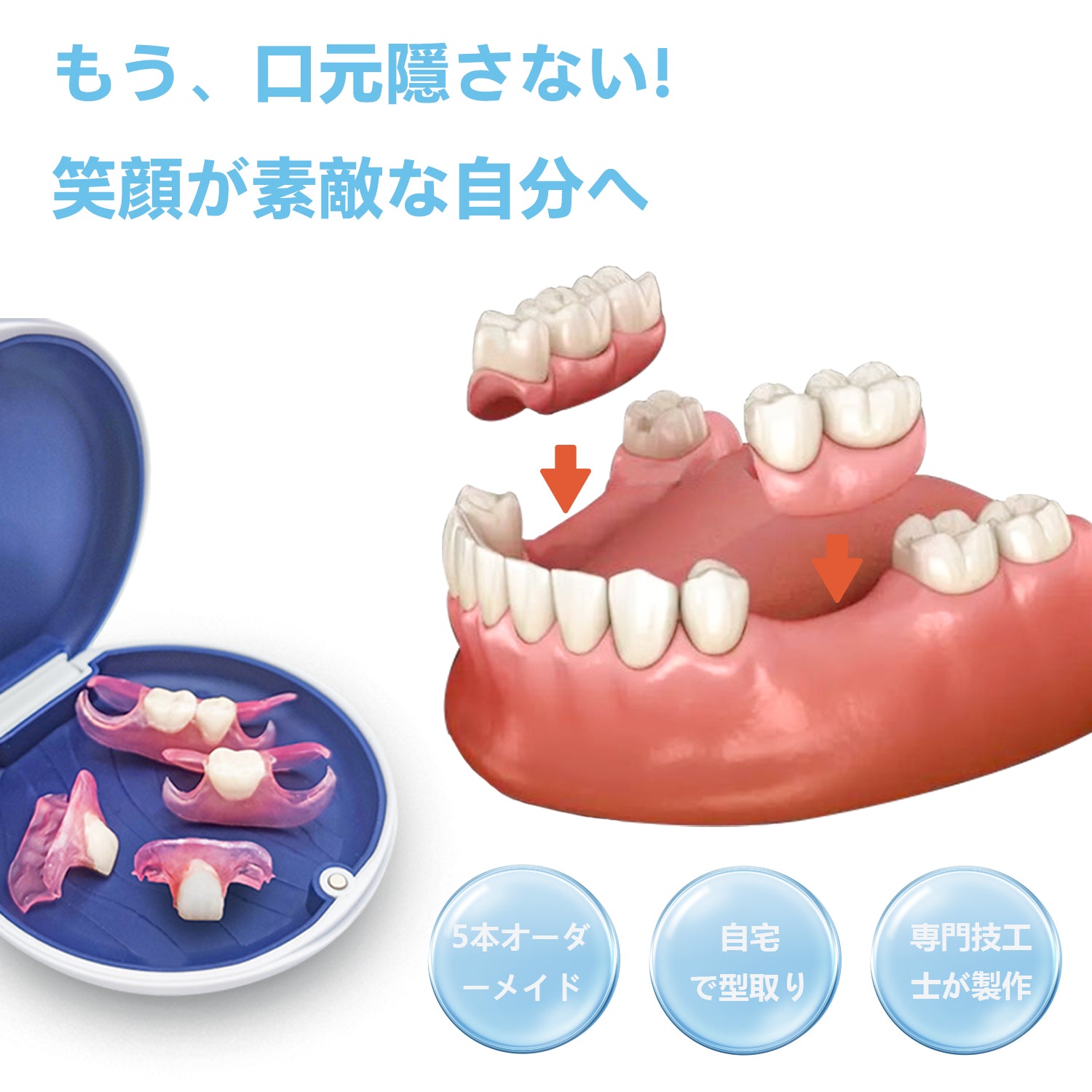 5本 カスタム 入れ歯 部分 取り外し可能 Dentellea 義歯 携帯便利 自然