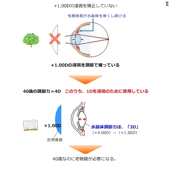 □「屈折異常と、その矯正 vol.2」老眼になったら・・ – 眼と眼鏡 / To