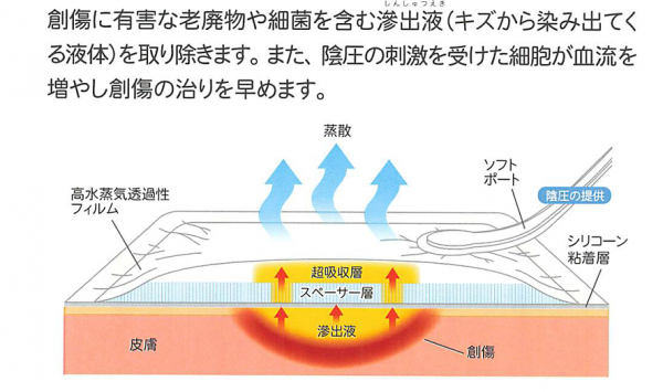 PICO7創傷治癒システム」のオンライン勉強会 | どんぐりブログ