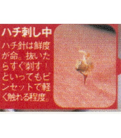 各種療法 | 整体町田施術院