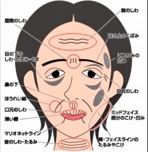 Tマジック美顔器キャンペーン | おしらせ