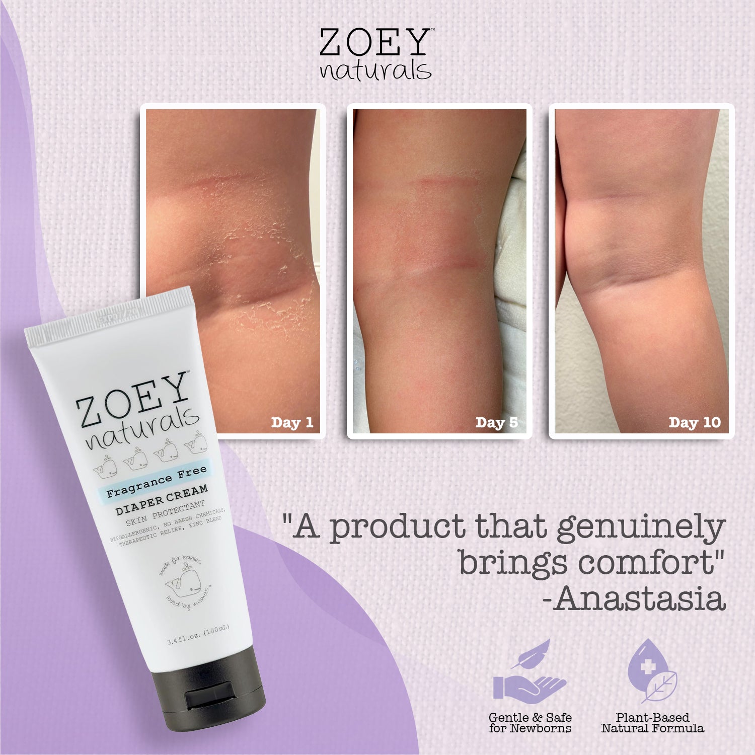 Zoey Naturals Zinc Oxide Diaper Rash Cream