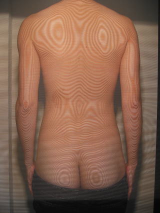 モアレ式体型観察撮影｜高橋整骨院