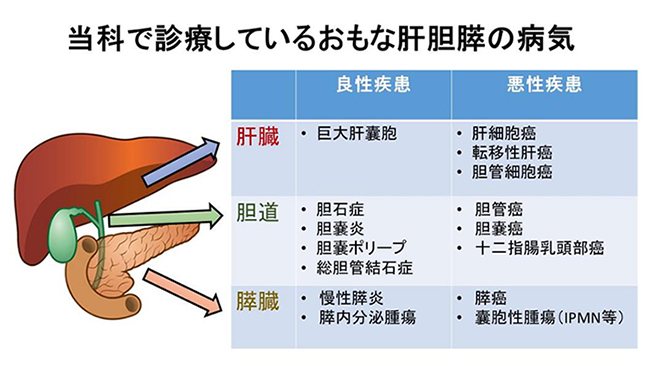 肝胆膵グループ｜診療案内｜産業医科大学 医学部 第1外科学教室[消化