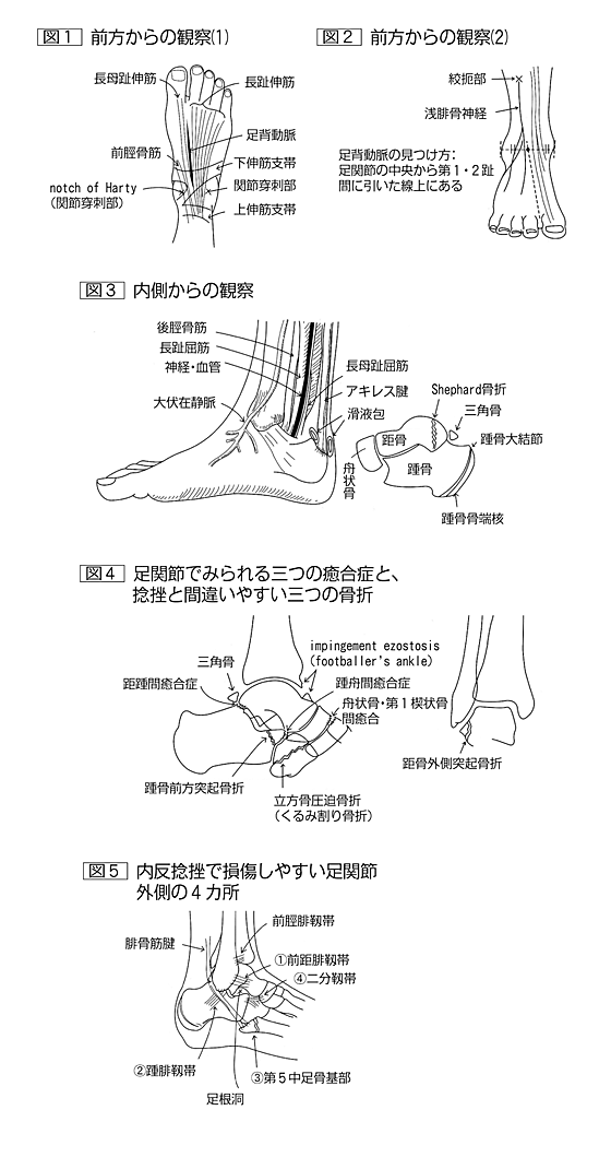 プライマリケアのための関節のみかた 下肢編(1)―足を診る(下) [臨床
