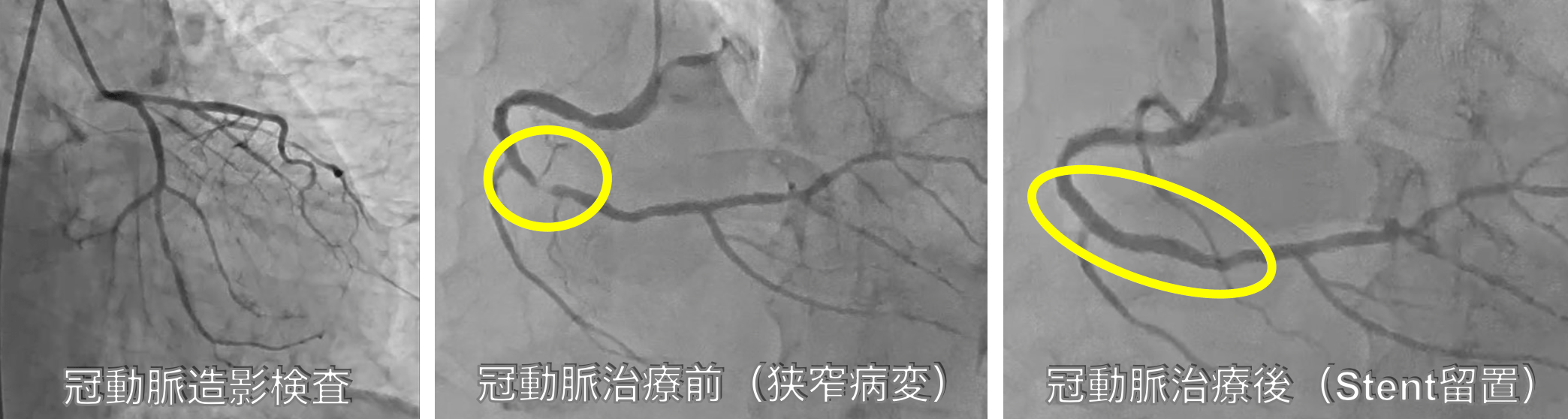 心・血管カテーテル検査/治療業務｜地方独立行政法人 佐世保市総合医療
