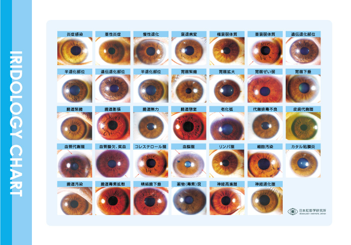虹彩学でカラダの健康チェック！ 【日本虹彩学研究所】