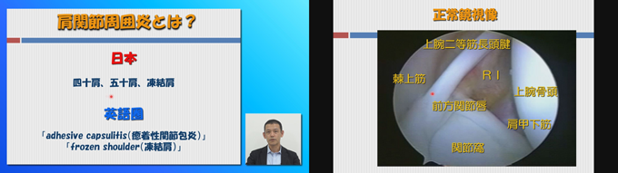 肩関節周囲炎に対する理学療法【DVD3枚組・分売不可】 肩関節周囲炎