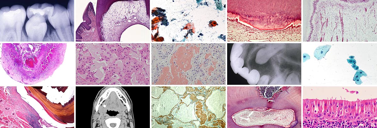 口腔病理基本画像アトラス