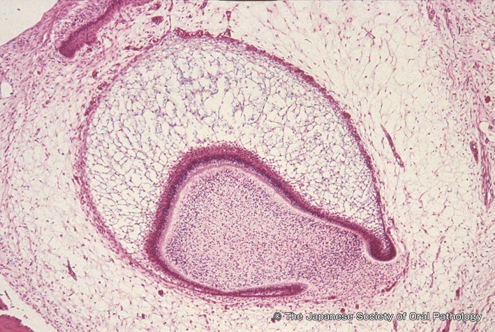 歯の発生と組織学 | 口腔病理基本画像アトラス