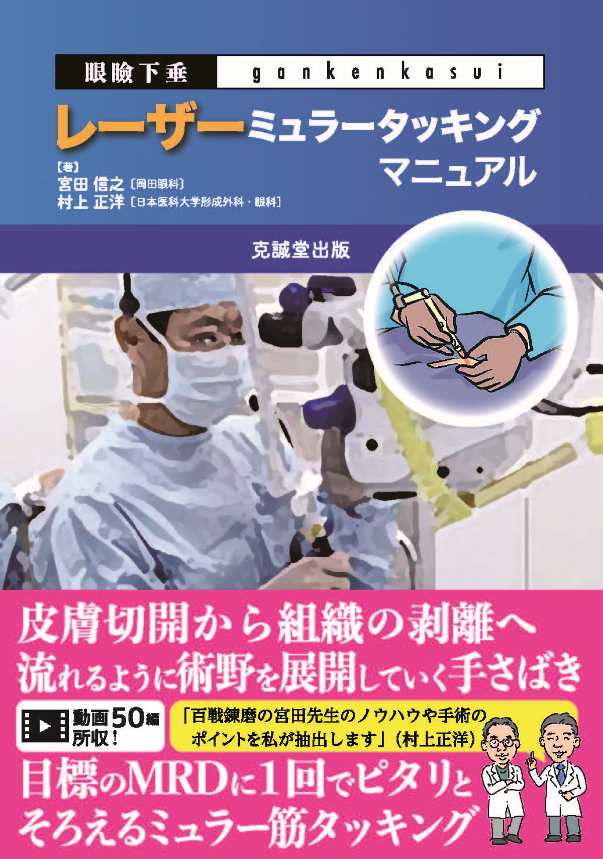 眼科 | 克誠堂出版 眼瞼下垂レーザーミュラータッキングマニュアル