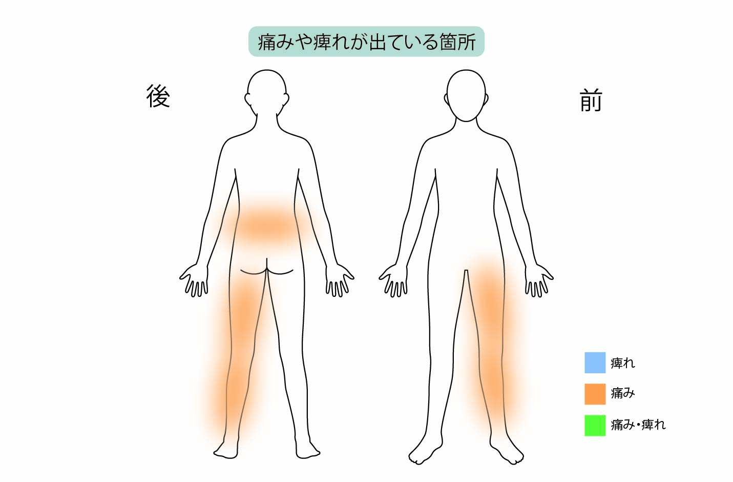 50代女性「腰椎椎間板ヘルニアが原因の腰痛を『PED（内視鏡下椎間板