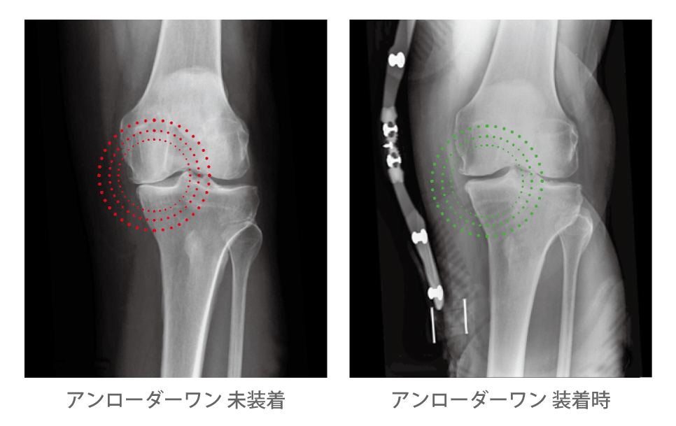 アンローダーワン | オズール製品・ソリューションカタログ