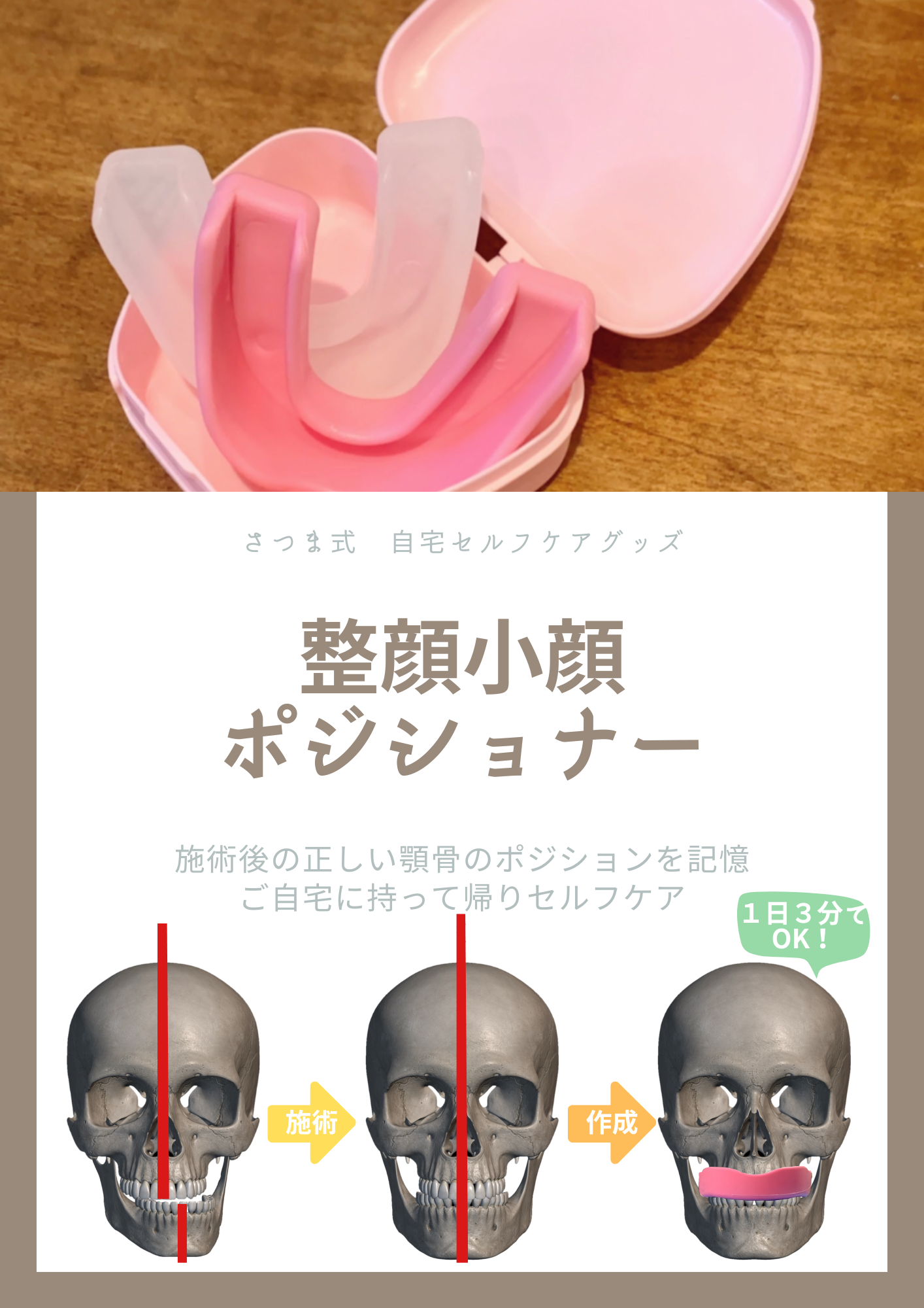 さつまの歪み小顔矯正と「小顔マウスピース」 | さつま骨格矯正鍼灸整骨院