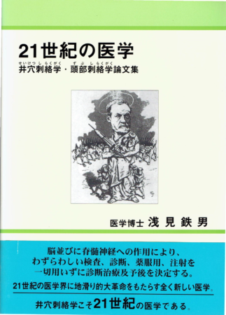 刺絡《しらく》療法（井穴《せいけつ》刺絡・頭部《ずぶ》刺絡・細絡