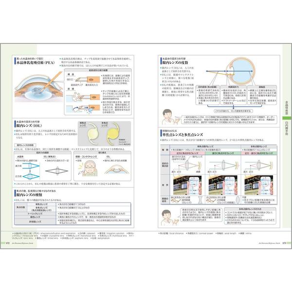 病気がみえる vol.12 眼科 眼科 通販｜セブンネットショッピング