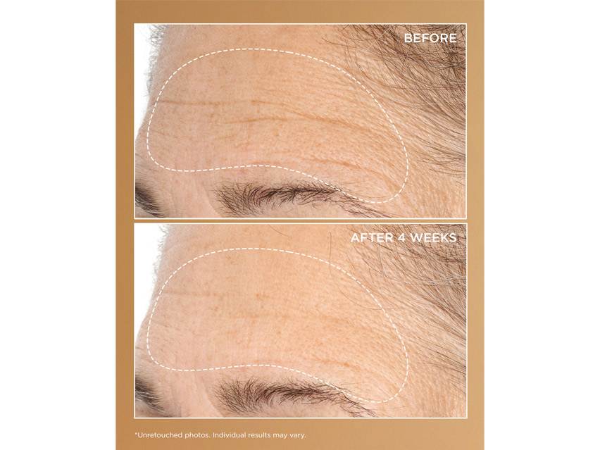 Perricone MD Neuropeptide Deep Crease Serum | LovelySkin