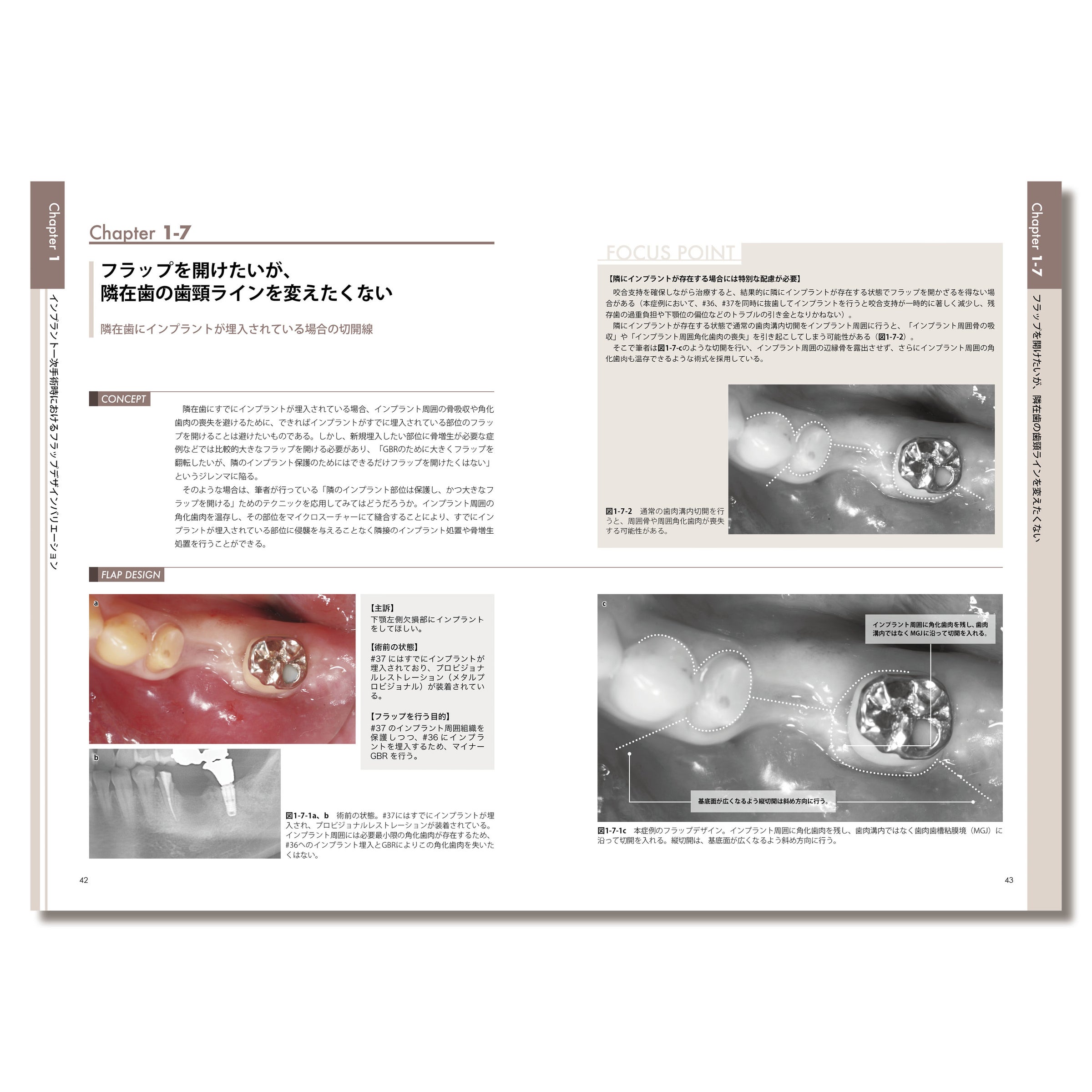 636 このシチュエーションに この切開 フラップデザインアルバム