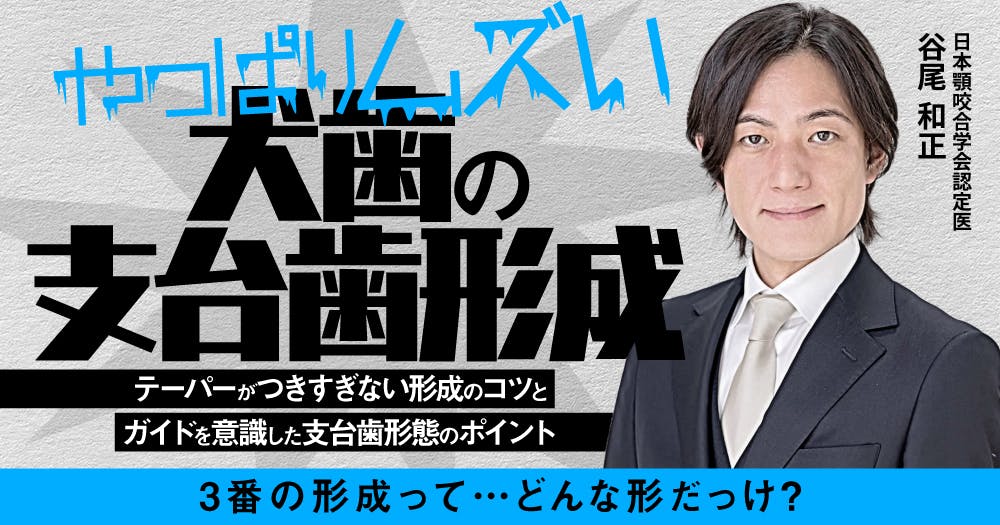やっぱりムズい「犬歯の支台歯形成」｜歯科オンラインセミナー・録画