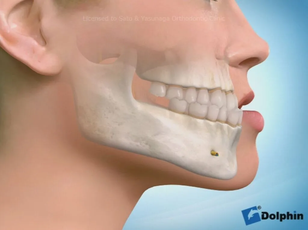 矯正歯科｜久留米｜ 田島歯科矯正口腔外科クリニック