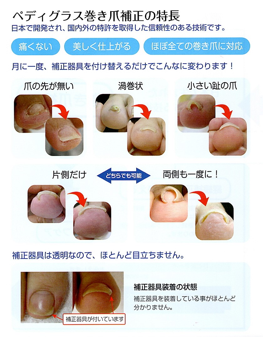 さわこ】ペディグラス ビックフォークスタイル左右10本ずつ さわこ様