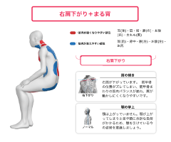 姿勢／動作検査 | 新宿No.1実績｜選ばれる整体・鍼灸院｜メディカル