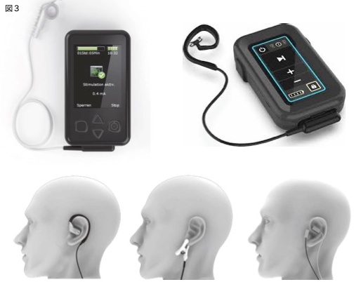 経皮的耳介迷走神経刺激 – TENS-PRODUCT