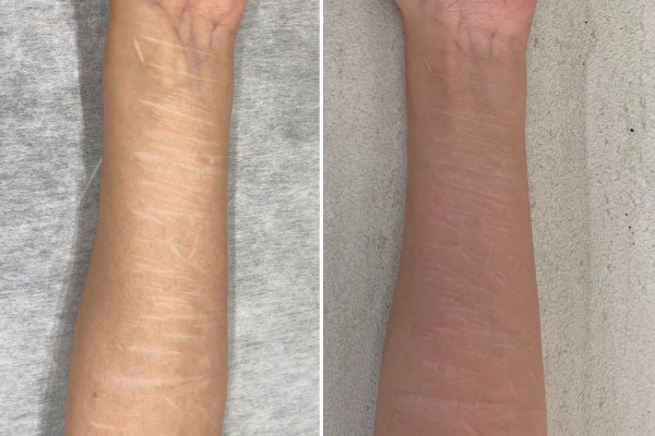 ザ・ナイン・メディカルアートメイク | The9 medical artmake【公式】