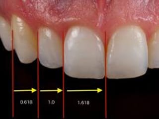 審美歯科治療 - 盛岡（盛岡市）の歯医者、医療法人啓仁会 栃内歯科医院