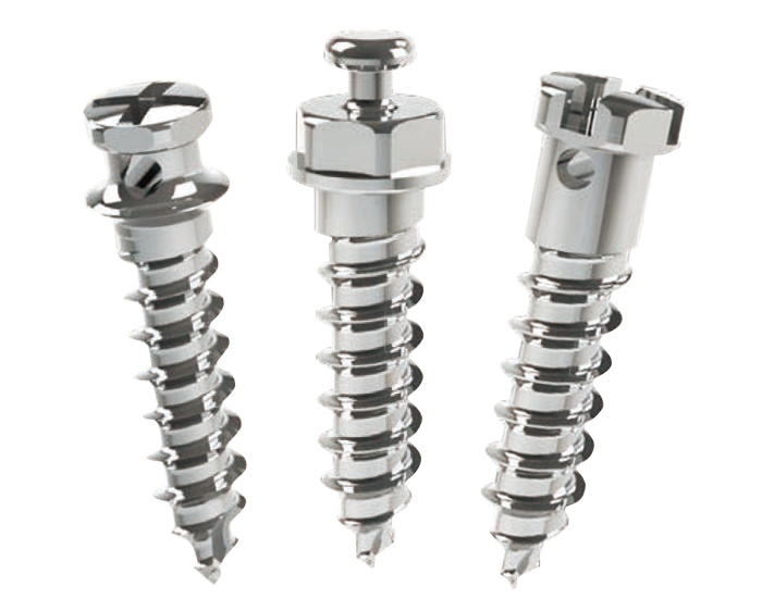 歯科矯正用アンカースクリューを用いた矯正 | 東京八重洲矯正歯科