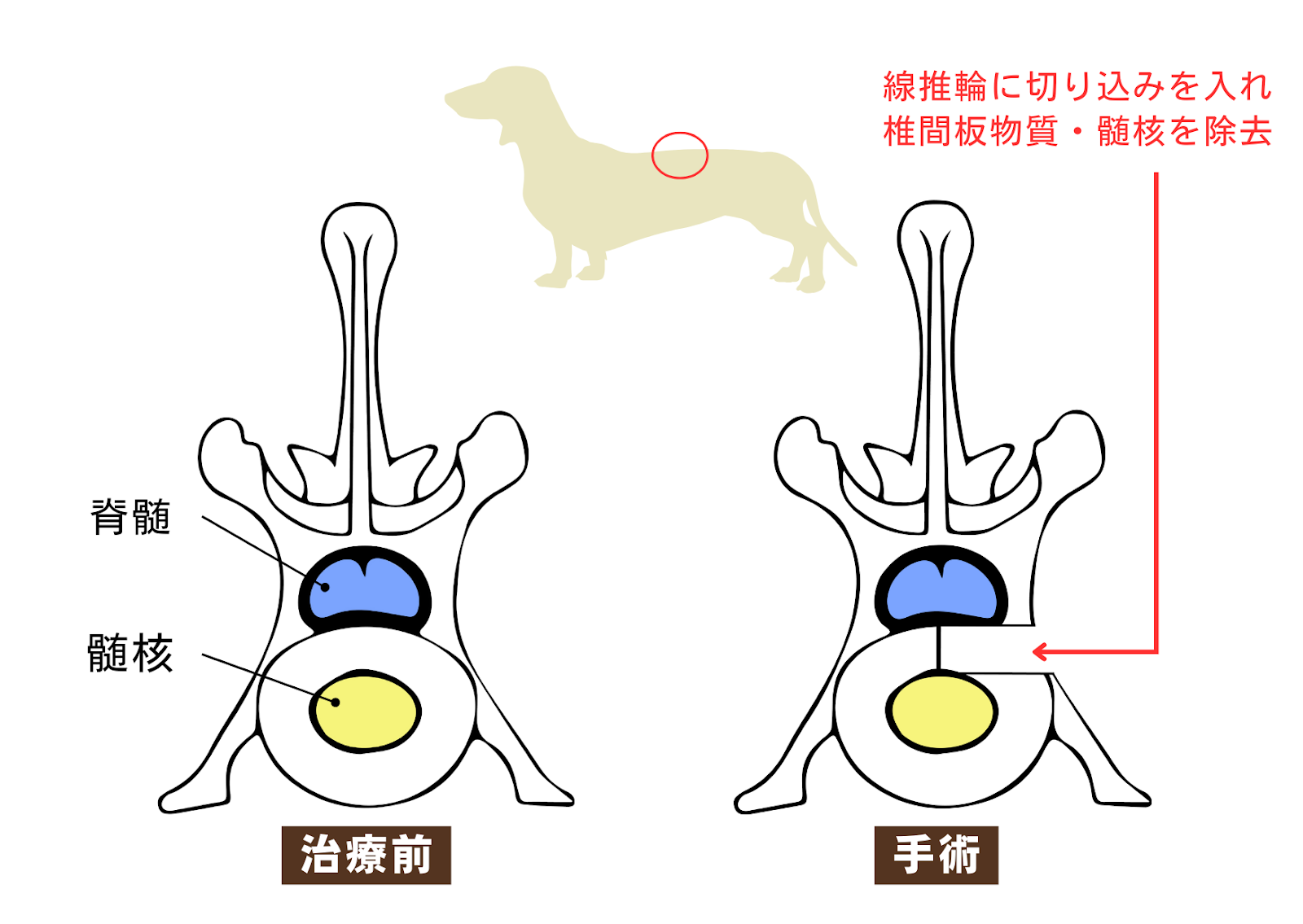 犬の胸腰部椎間板ヘルニアの手術方法について| 埼玉県三郷市の動物病院
