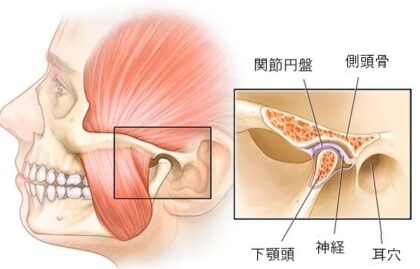 あごガクガク顎関節症（TMD）とは | トワデンタルクリニック人形町