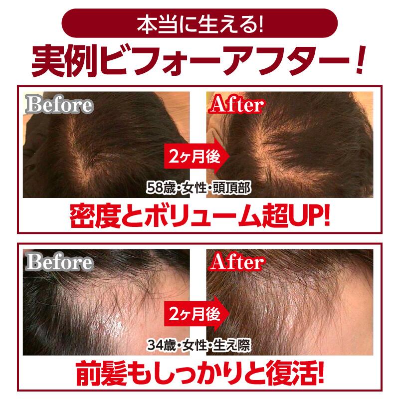 楽天市場】【正規品取扱店】【レビューで「ヘアオイル」プレゼント