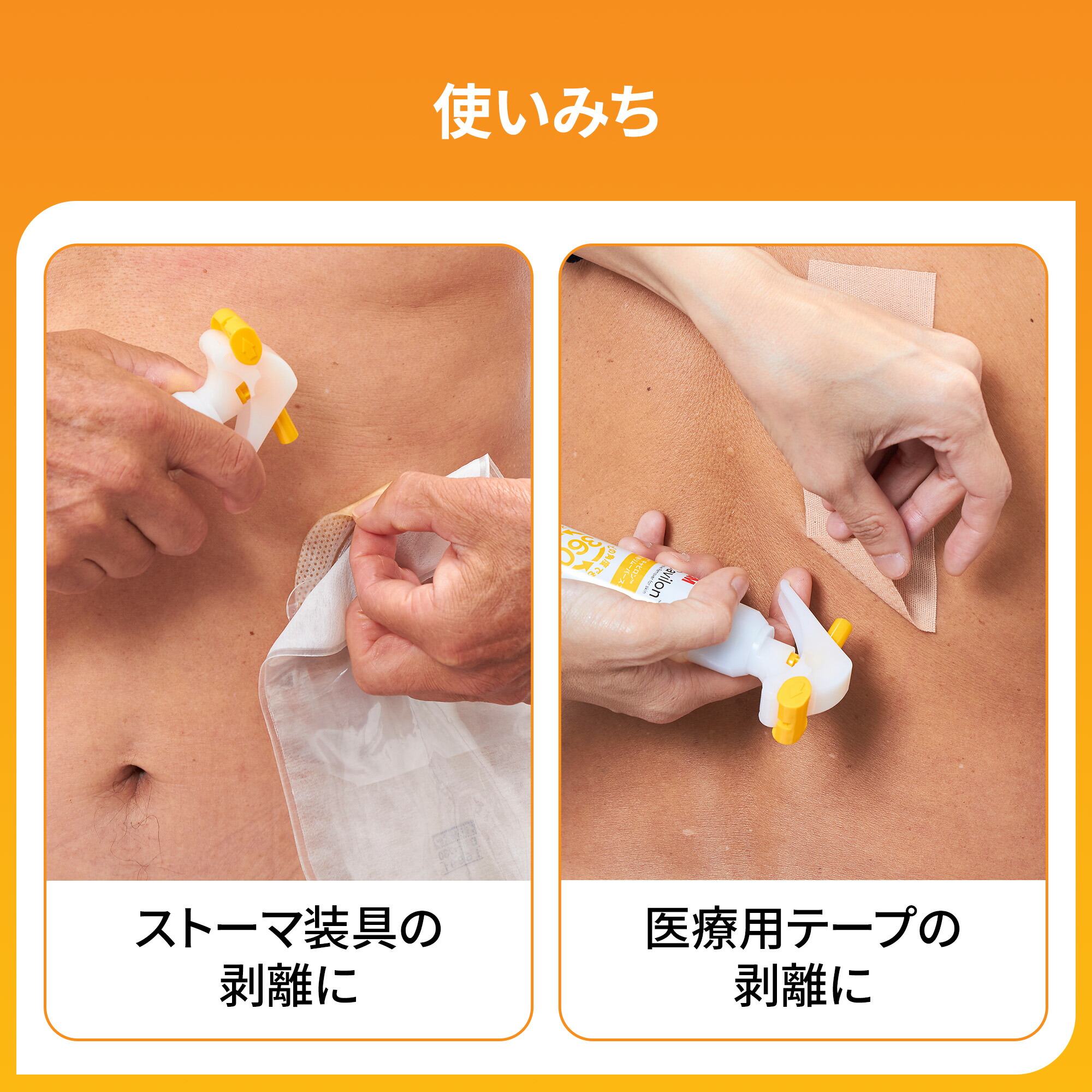 楽天市場】【国内正規品】3M キャビロン 皮膚用リムーバー スプレー