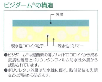 楽天市場】ビジダーム 5x7.5cm VD57510 100枚/箱 コンバテック【皮膚