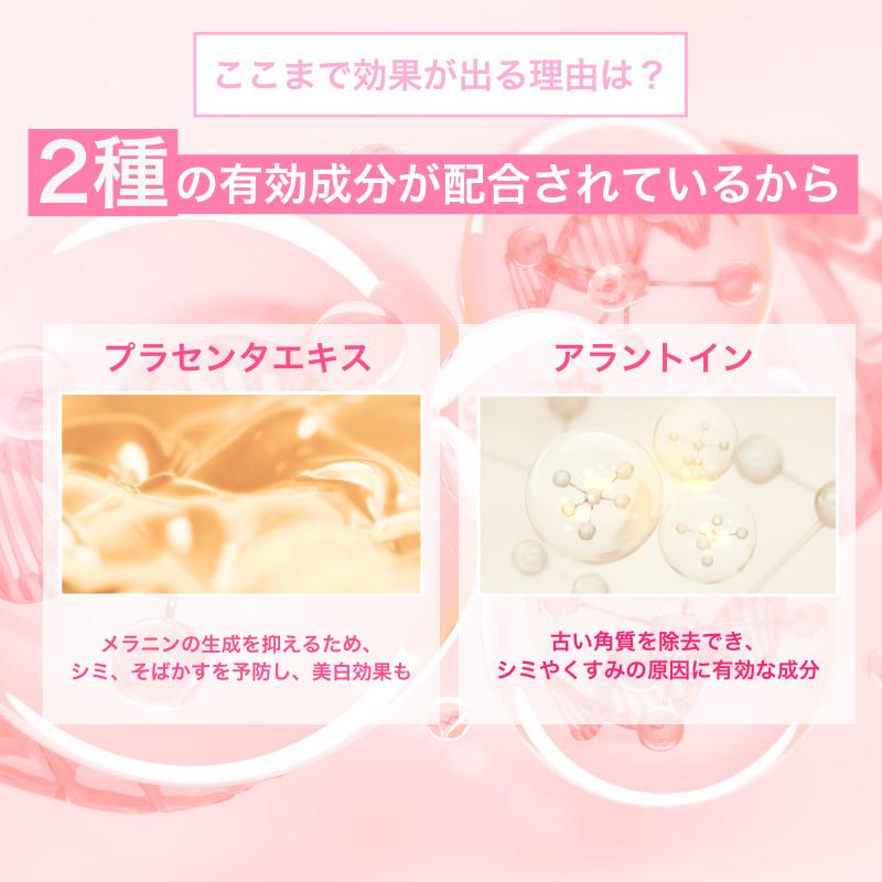 楽天市場】【黒ずみケア☆楽天1位】 デリケートゾーン 黒ずみ VIO 美白