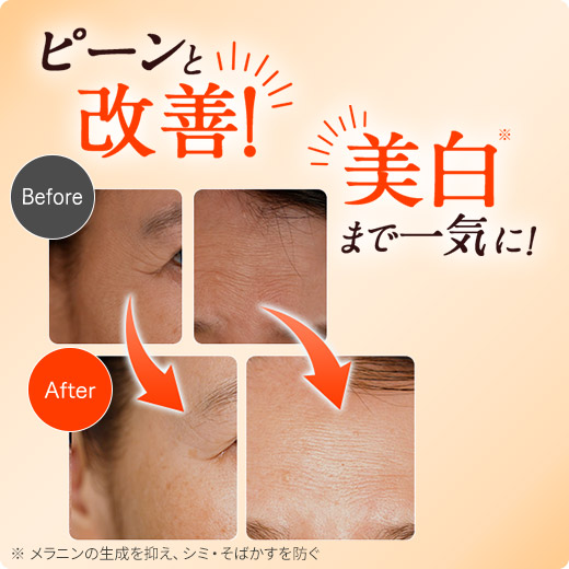 楽天市場】ローヤルゼリーパーフェクトジェル＜医薬部外品＞ 50g