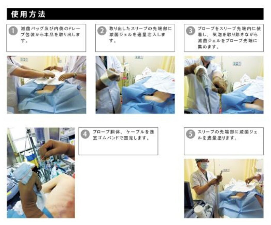 楽天市場】エコープローブカバーII（人体開口部用・術中用） スリーブ