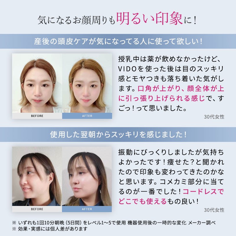 楽天市場】【送料無料/正規品】MYTREX VIDO マイトレックス ヘッド