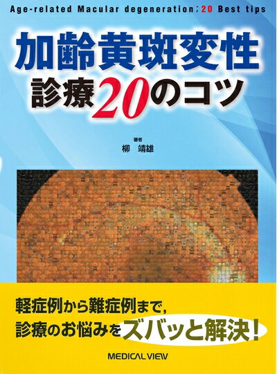楽天市場】加齢黄斑変性 診療20のコツの通販