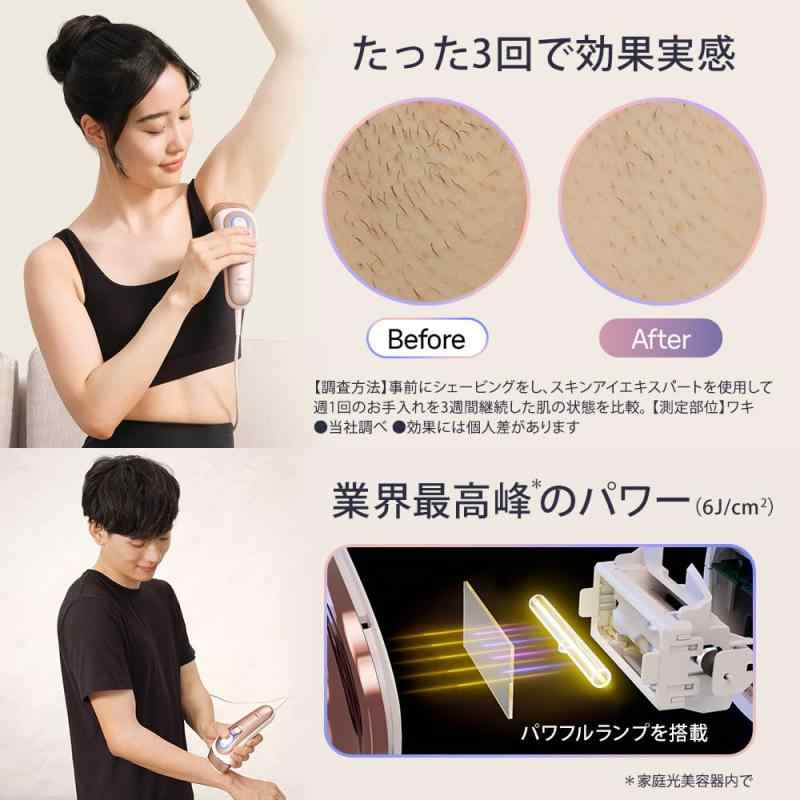 楽天市場】ブラウン 脱毛器 スキンアイエキスパート Pro7 男女兼用 VIO