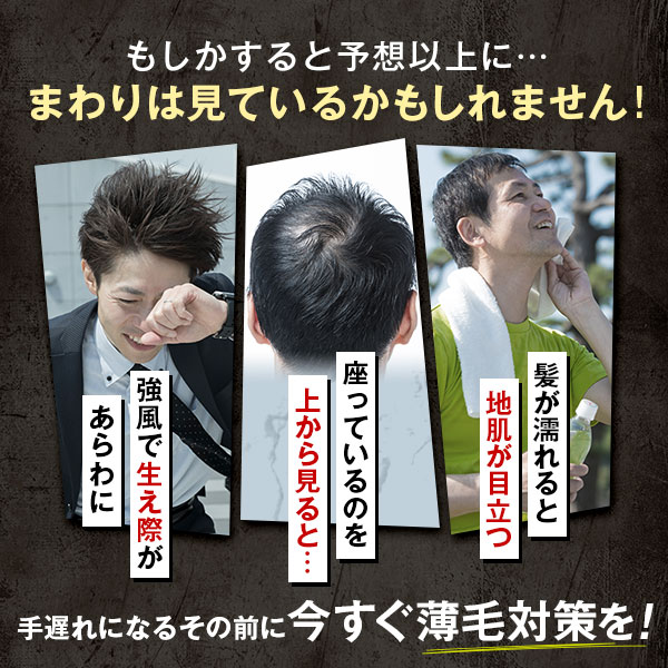 楽天市場】【全額返金保証】 送料無料 公式 チャップアップ CHAP UP