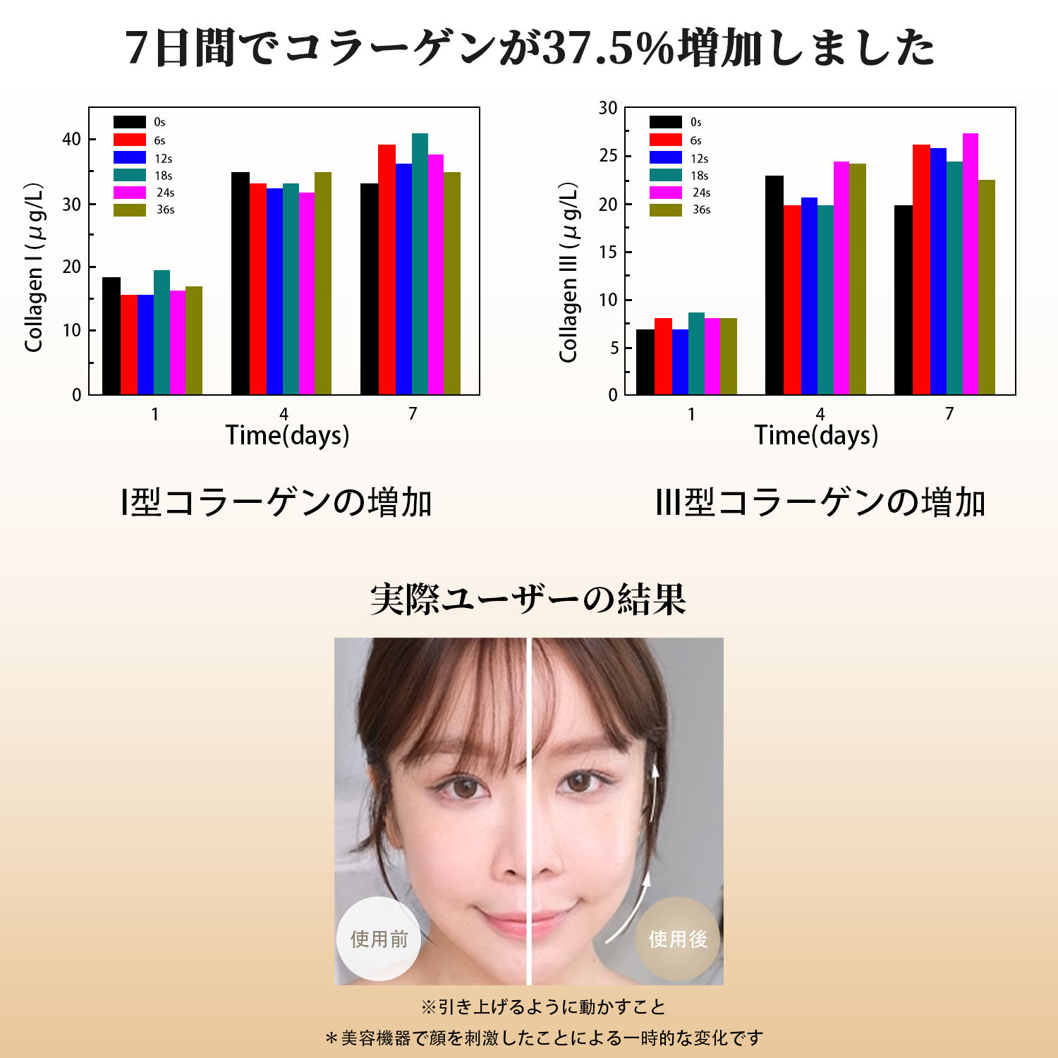 楽天市場】【時間限定10%OFF配布+1年間保証】AMIRO 美顔ローラー RF