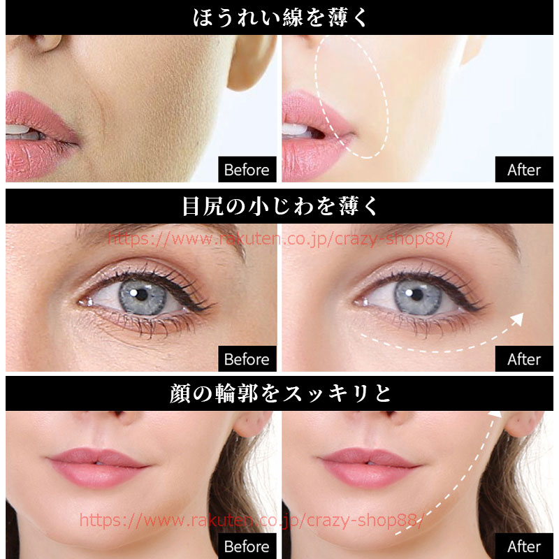 楽天市場】美顔器 高周波 多機能美顔器 RFラジオ波 浸透 毛穴ケア EMS