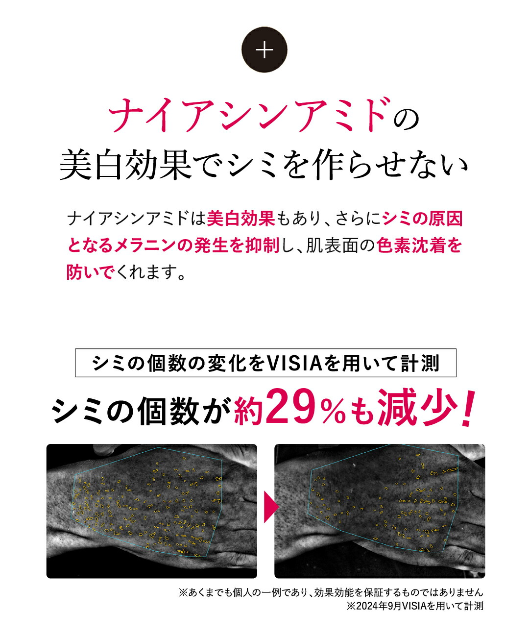 楽天市場】【公式】 ハンドクリーム 血管 シワ シミ 美白 Sirojam