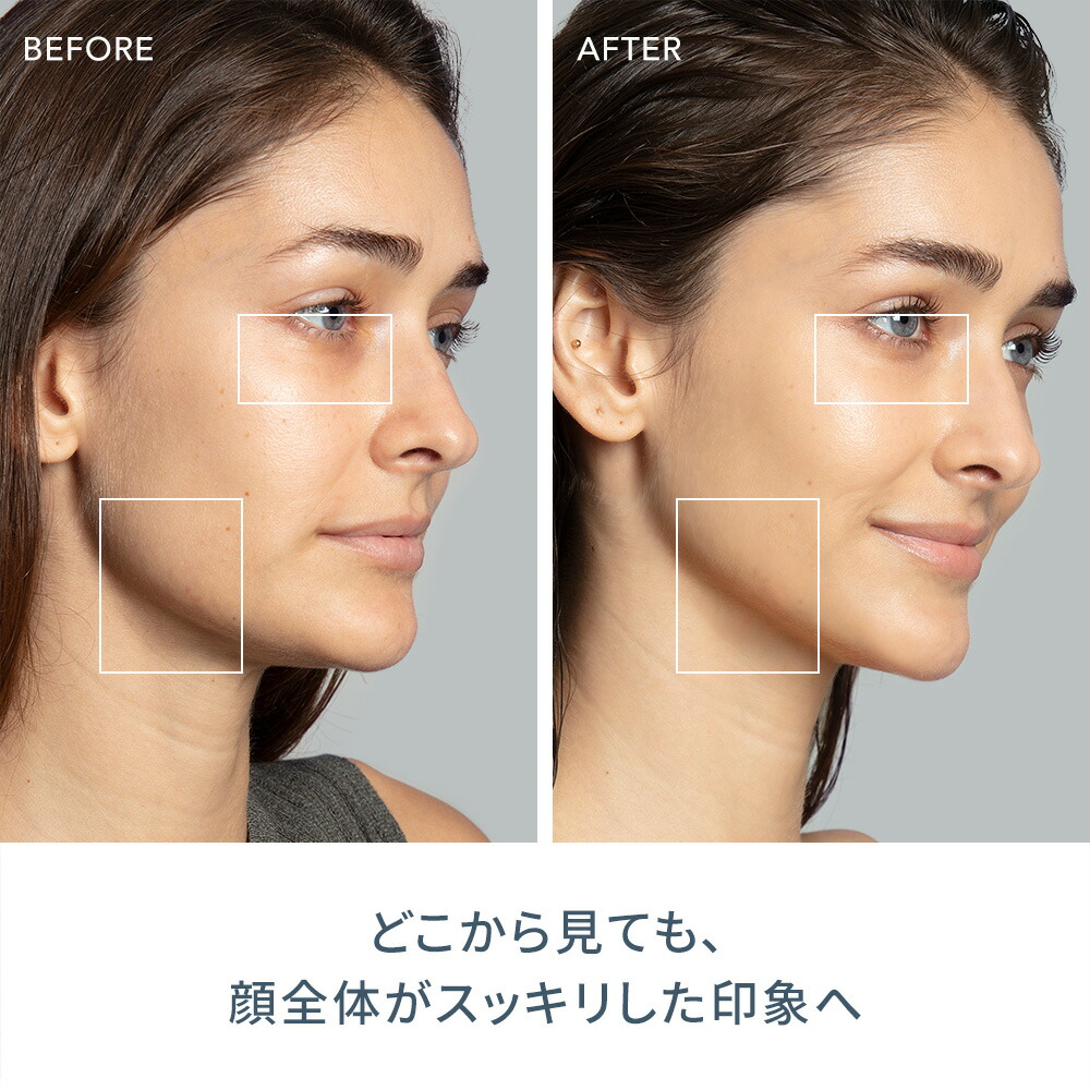 楽天市場】美顔器 BEAR 2 ベア スマート マイクロカレント