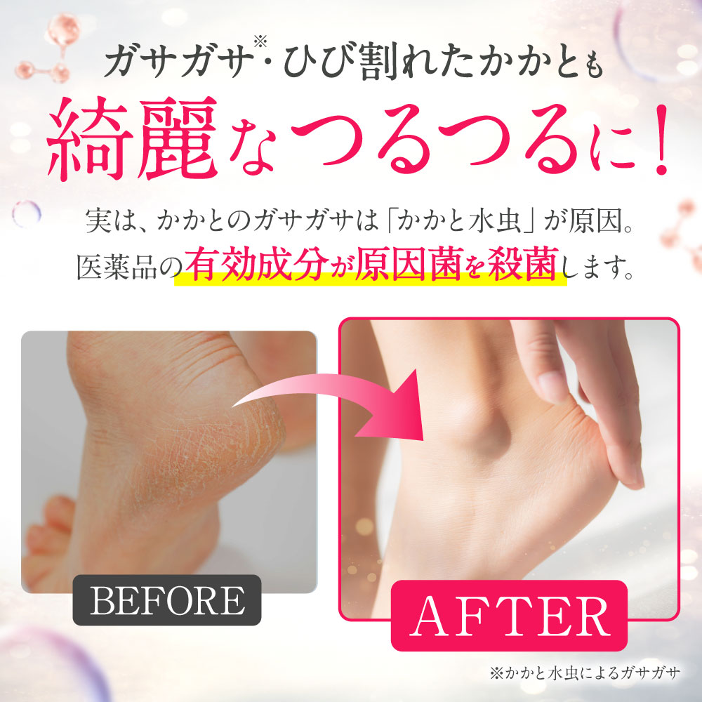 楽天市場】【第2類医薬品】水虫薬 20g nicomedico いんきんたむし ぜに