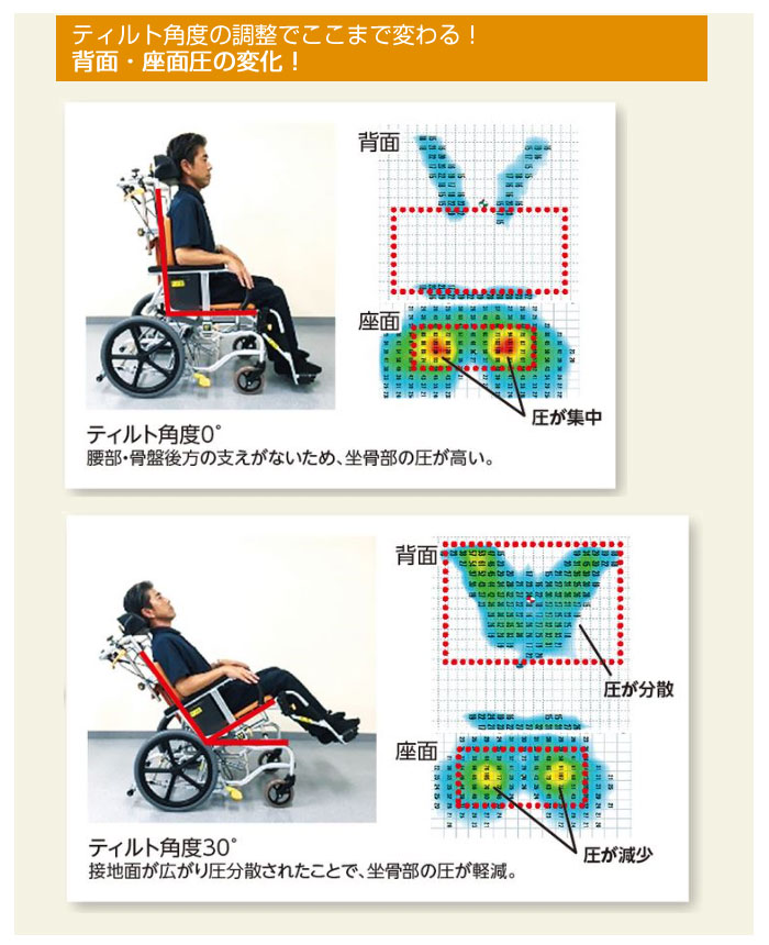 楽天市場】車椅子【松永製作所 マイチルト-バリュー MH-VR-SE